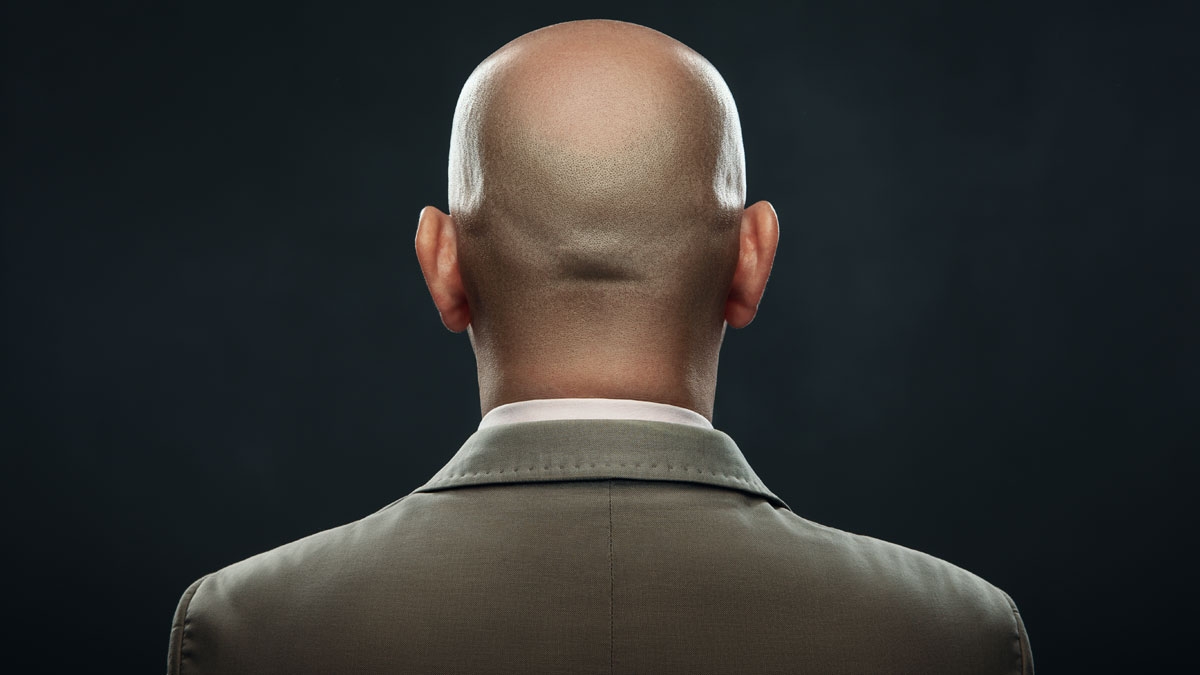 Studie: Männer, die zu viel arbeiten, bekommen eine Glatze