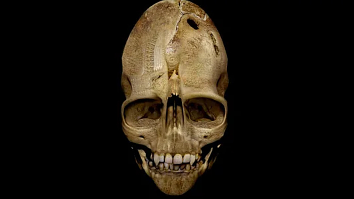 „The Andover Skull“: Der Beweis für Vampirismus?