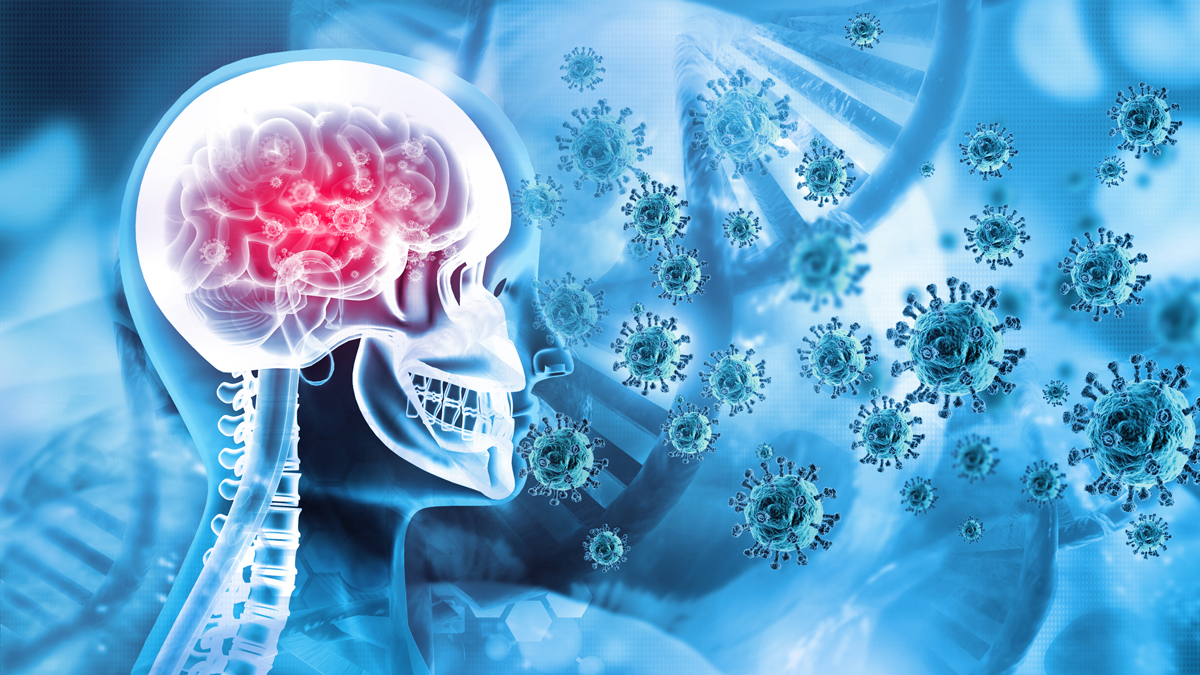 Studie: So wirkt sich Covid-19 auf das Gehirn aus