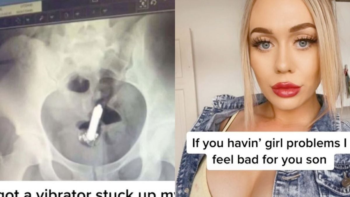 Vibrator-Unfall: Influencerin muss operiert werden