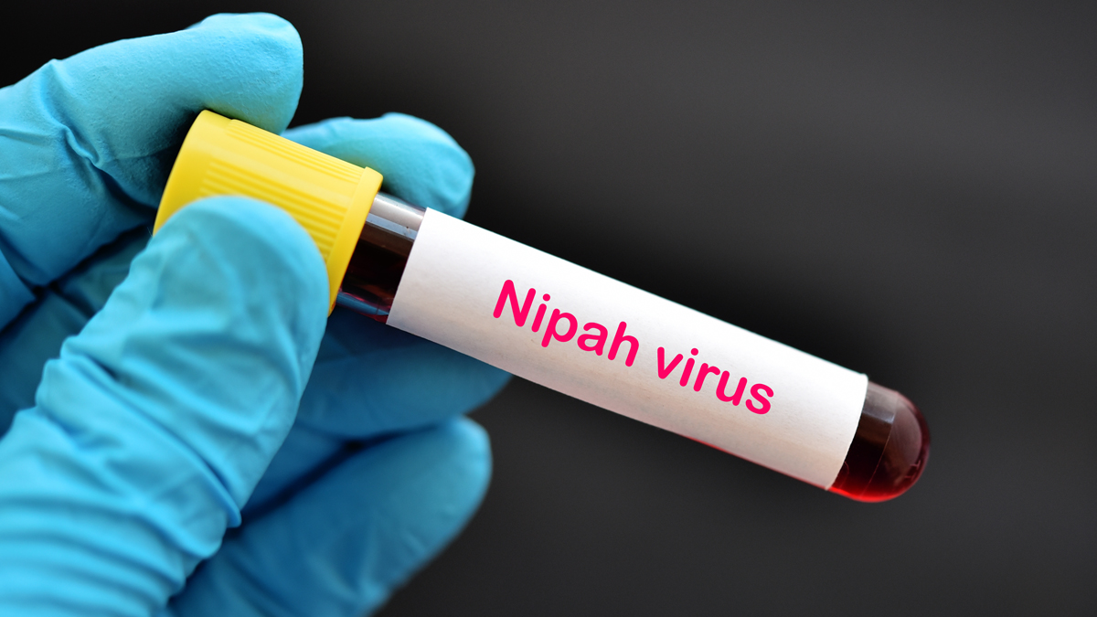 Bedrohung durch Nipah-Virus: Indien veranlasst Lockdown