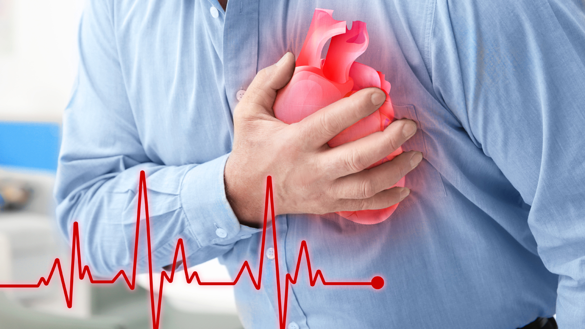 Herzinfarkt: An diesen Symptomen erkennt man ihn