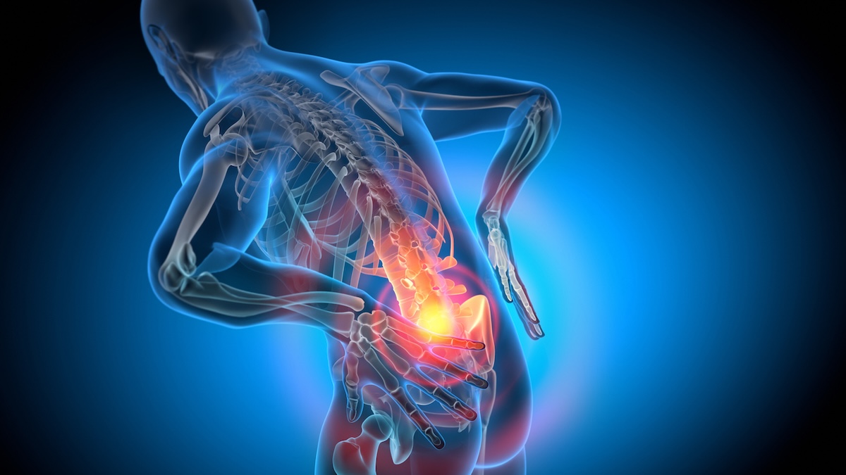 3D-Darstellung einer Person mit Rückenschmerzen